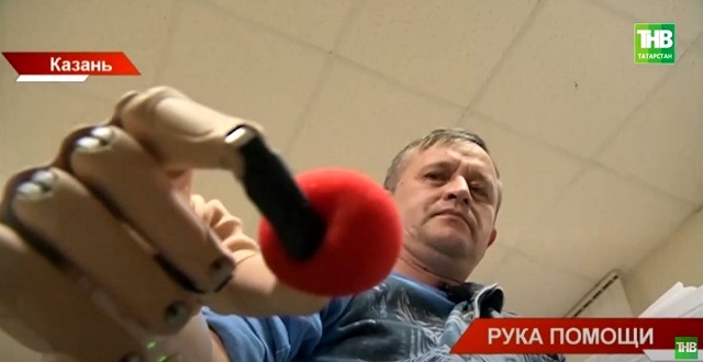 Рука помощи: татарстанец бесплатно получил бионический протез за 2 млн рублей