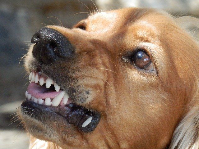 Полиция Казани отказала в возбуждении уголовного дела по факту нападения бойцовской собаки на школьницу