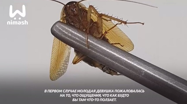 Живой таракан прожил несколько дней в голове беременной россиянки - видео