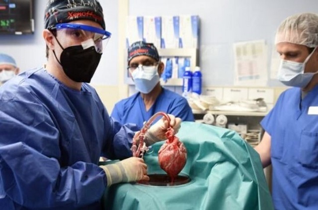 В США врачи успешно пересадили человеку свиное сердце - видео