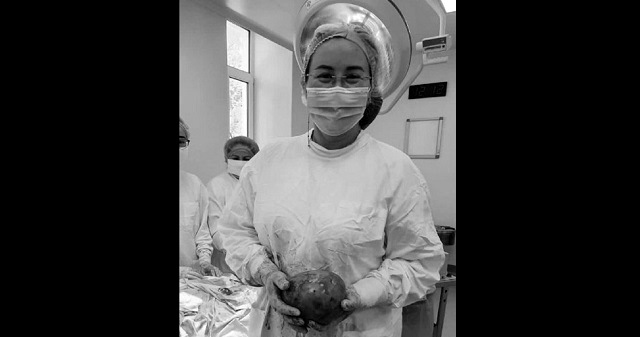 В Уфе врачи удалили из матки беременной пациентки килограммовую опухоль