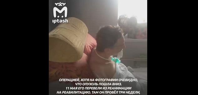 В Татарстане мужчина остался прикованным к постели после удаления зубов