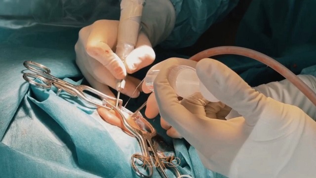 В Казани врачи ДРКБ восстановили разрушенное врожденной опухолью среднее ухо ребенка