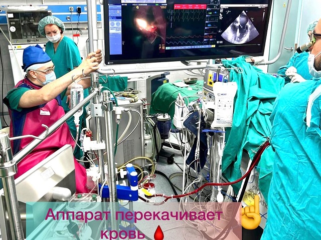 Кардиохирурги БСМП впервые в Татарстане провели операцию через подключичную артерию