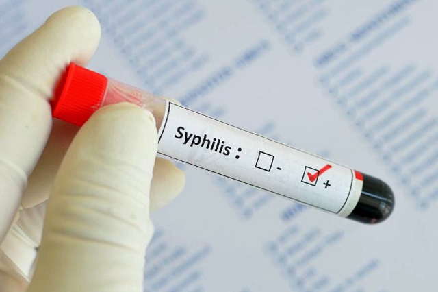 Роспотребнадзор сообщил о росте случаев заражения сифилисом в Татарстане