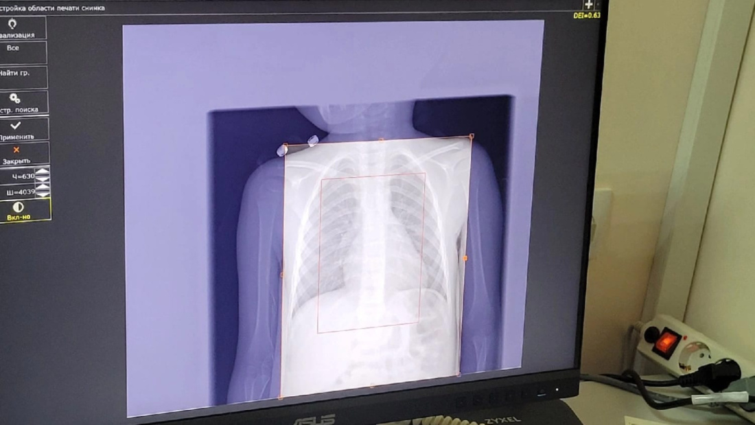 2 272 исследования провели на новом рентген-аппарате в Чистопольской ЦРБ по нацпроекту
