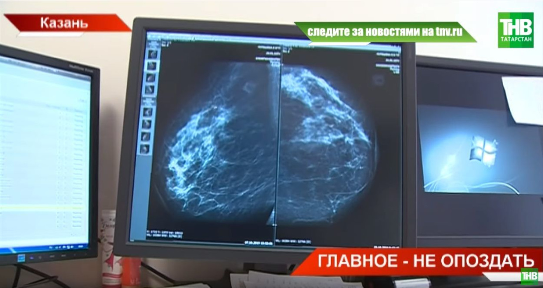 В Татарстане зафиксирован ежегодный рост заболевания раком груди (ВИДЕО)