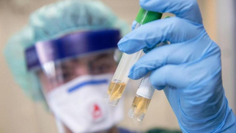 Более 31 000 тестов на коронавирус сделали в Татарстане