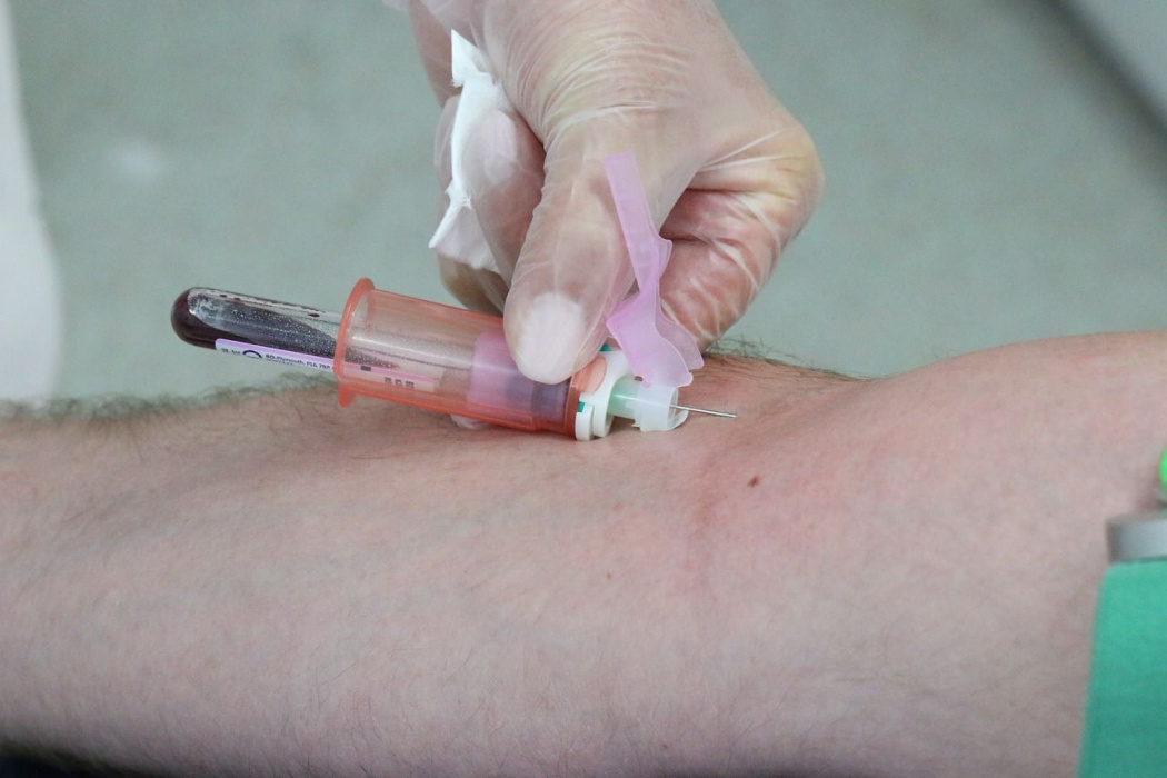Вакцины от коронавируса могут увеличивать риск заражения ВИЧ