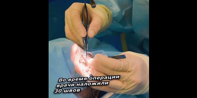 В Казани врачи ДРКБ спасли поврежденный куриной костью глаз ребенка – видео